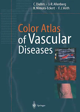 E-Book (pdf) Color Atlas of Vascular Diseases von C. Diehm, J. -R. Allenberg, K. Nimura-Eckert