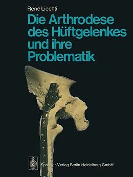E-Book (pdf) Die Arthrodese des Hüftgelenkes und ihre Problematik von R. Liechti