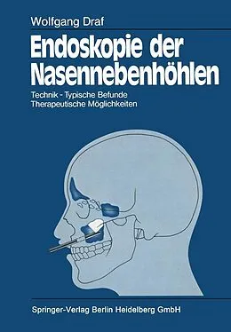 E-Book (pdf) Endoskopie der Nasennebenhöhlen von Wolfgang Draf