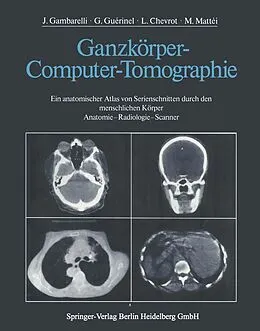 E-Book (pdf) Ganzkörper-Computer-Tomographie von J. Gambarelli, G. Guerinel, L. Chevrot