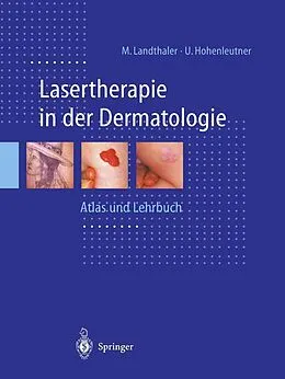 E-Book (pdf) Lasertherapie in der Dermatologie von Michael Landthaler, Ulrich Hohenleutner