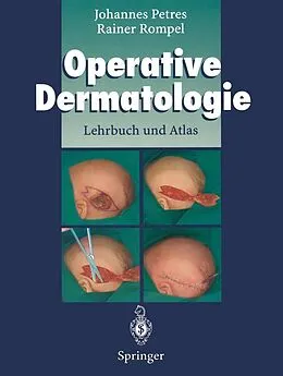 E-Book (pdf) Operative Dermatologie von Johannes Petres, Rainer Rompel, Robert Darroll