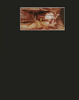 E-Book (pdf) Photographischer Atlas der Praktischen Anatomie II von Walter Thiel