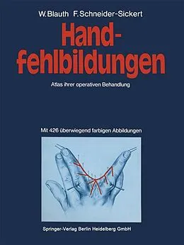 E-Book (pdf) Handfehlbildungen von W. Blauth, F. Schneider-Sickert