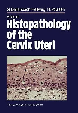 E-Book (pdf) Atlas of Histopathology of the Cervix Uteri von Gisela Dallenbach-Hellweg, Magnus von Knebel Doeberitz, Marcus J. Trunk-Gemacher