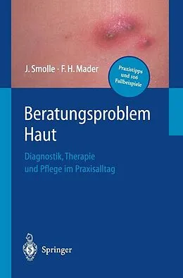 E-Book (pdf) Beratungsproblem Haut von Josef Smolle, Frank H. Mader