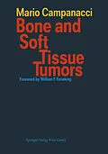 E-Book (pdf) Bone and Soft Tissue Tumors von Mario Campanacci