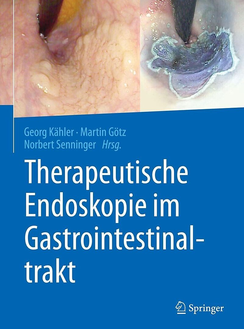 Therapeutische Endoskopie im Gastrointestinaltrakt