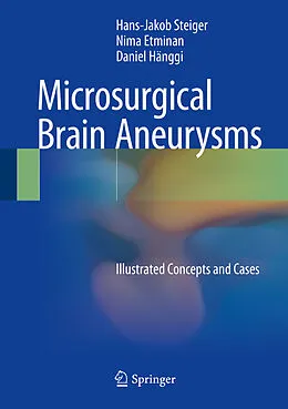 E-Book (pdf) Microsurgical Brain Aneurysms von Hans-Jakob Steiger, Nima Etminan, Daniel Hänggi