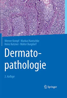 E-Book (pdf) Dermatopathologie von Werner Kempf, Markus Hantschke, Heinz Kutzner