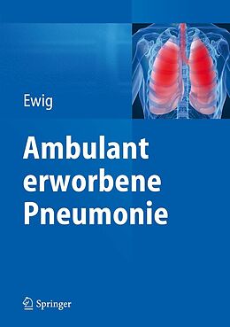 E-Book (pdf) Ambulant erworbene Pneumonie von 