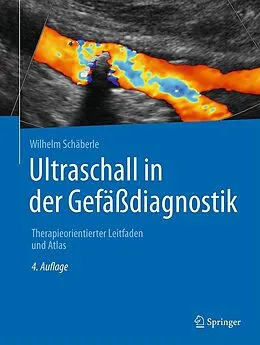 E-Book (pdf) Ultraschall in der Gefäßdiagnostik von Wilhelm Schäberle
