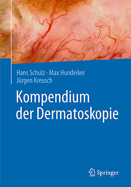 Fester Einband Kompendium der Dermatoskopie von Hans Schulz, Max Hundeiker, Jürgen Kreusch