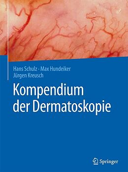 E-Book (pdf) Kompendium der Dermatoskopie von Hans Schulz, Max Hundeiker, Jürgen Kreusch