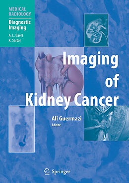 Couverture cartonnée Imaging of Kidney Cancer de 