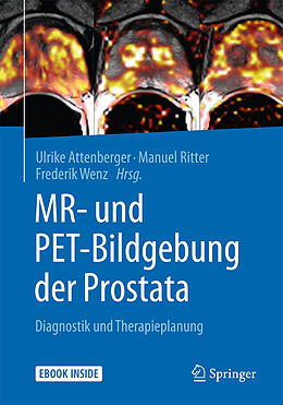 Fester Einband MR- und PET-Bildgebung der Prostata von 
