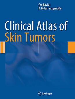 Kartonierter Einband Clinical Atlas of Skin Tumors von K. Didem Yazgano lu, Can Baykal