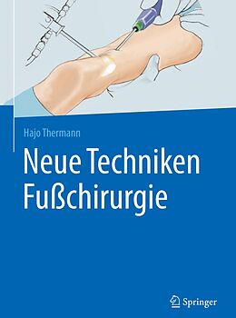 E-Book (pdf) Neue Techniken Fußchirurgie von Hajo Thermann