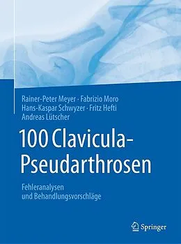 E-Book (pdf) 100 Clavicula-Pseudarthrosen von Rainer-Peter Meyer, Fabrizio Moro, Hans-Kaspar Schwyzer