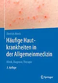 E-Book (pdf) Häufige Hautkrankheiten in der Allgemeinmedizin von Dietrich Abeck