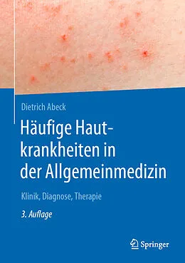 E-Book (pdf) Häufige Hautkrankheiten in der Allgemeinmedizin von Dietrich Abeck