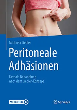 E-Book (pdf) Peritoneale Adhäsionen von Michaela Liedler