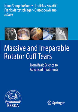 Couverture cartonnée Massive and Irreparable Rotator Cuff Tears de 