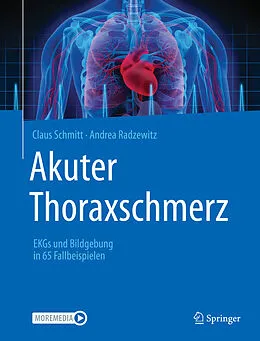 E-Book (pdf) Akuter Thoraxschmerz von Claus Schmitt, Andrea Radzewitz