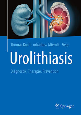 E-Book (pdf) Urolithiasis von 