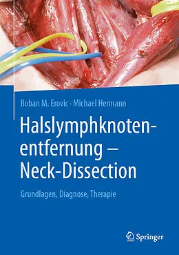 E-Book (pdf) Halslymphknotenentfernung  Neck-Dissection von Boban M. Erovic, Michael Hermann