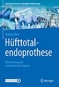 E-Book (pdf) Hüfttotalendoprothese: minimalinvasiver anterolateraler Zugang von Andreas Roth