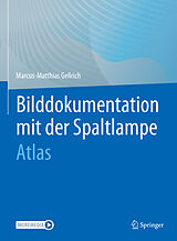 E-Book (pdf) Bilddokumentation mit der Spaltlampe von Marcus-Matthias Gellrich