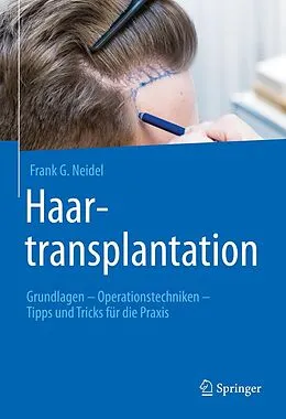 E-Book (pdf) Haartransplantation von Frank G. Neidel