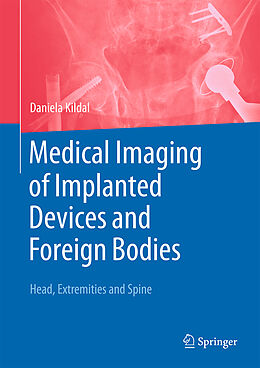 Livre Relié Medical Imaging of Implanted Devices and Foreign Bodies de 