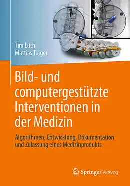 E-Book (pdf) Bild- und computergestützte Interventionen in der Medizin von Tim Christian Lüth, Mattias Felix Träger