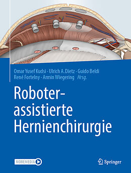 Fester Einband Roboterassistierte Hernienchirurgie von 