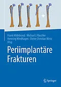 E-Book (pdf) Periimplantäre Frakturen von 