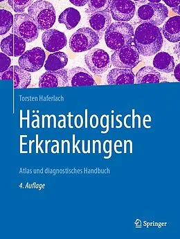 E-Book (pdf) Hämatologische Erkrankungen von Torsten Haferlach