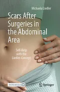 E-Book (pdf) Scars After Surgeries in the Abdominal Area von Michaela Liedler