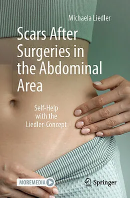E-Book (pdf) Scars After Surgeries in the Abdominal Area von Michaela Liedler