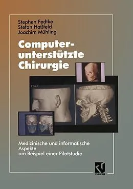 E-Book (pdf) Computerunterstützte Chirurgie von Stephen Fedtke