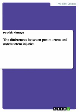 eBook (pdf) The differences between postmortem and antemortem injuries de Patrick Kimuyu