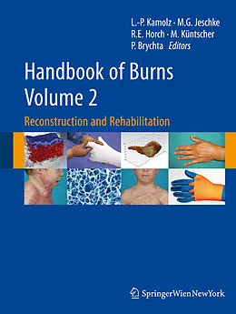 E-Book (pdf) Handbook of Burns Volume 2 von Lars-Peter Kamolz, Marc G. Jeschke, Raymund E. Horch