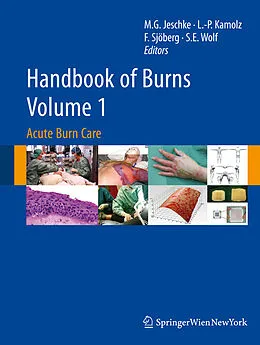 E-Book (pdf) Handbook of Burns Volume 1 von Marc G. Jeschke, Lars-Peter Kamolz, Folke Sjöberg