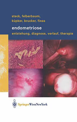 E-Book (pdf) Endometriose von Thomas Steck, Ricardo E. Felberbaum, Wolfgang Küpker