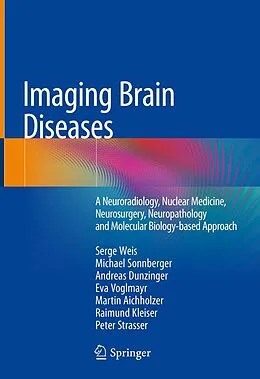 E-Book (pdf) Imaging Brain Diseases von Serge Weis, Michael Sonnberger, Andreas Dunzinger