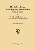 E-Book (pdf) Die Entwicklung der Lungentuberkulose im Röntgenbild von Erich Zdansky