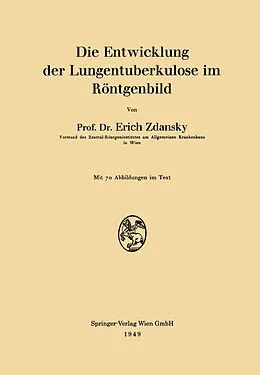E-Book (pdf) Die Entwicklung der Lungentuberkulose im Röntgenbild von Erich Zdansky