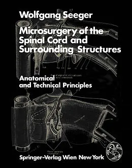 E-Book (pdf) Microsurgery of the Spinal Cord and Surrounding Structures von W. Seeger