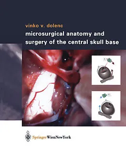 E-Book (pdf) Microsurgical Anatomy and Surgery of the Central Skull Base von Vinko V. Dolenc